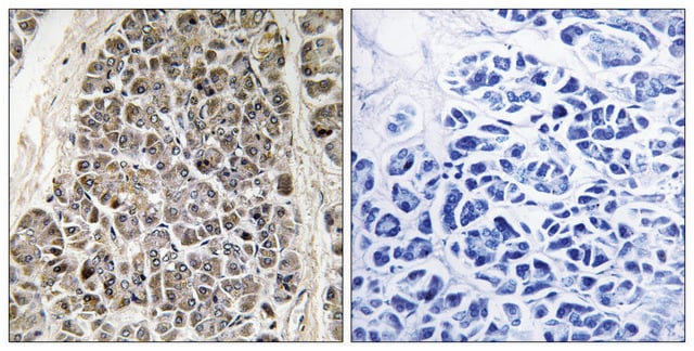 Anti-MRPS21 antibody produced in rabbit affinity isolated antibody