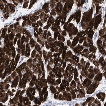 Anti-ICA1 antibody produced in rabbit Prestige Antibodies&#174; Powered by Atlas Antibodies, affinity isolated antibody, buffered aqueous glycerol solution