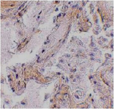 Anti-CAPN6 Antibody from rabbit, purified by affinity chromatography