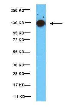 Anti-Phospho-fokale Adhäsionskinase (Tyr397)-Antikörper, Klon 18 clone 18, from mouse