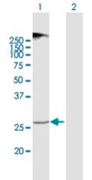 Anti-TMEM38A antibody produced in mouse purified immunoglobulin, buffered aqueous solution