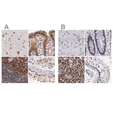 Anti-TERF2 antibody produced in rabbit Prestige Antibodies&#174; Powered by Atlas Antibodies, affinity isolated antibody, buffered aqueous glycerol solution