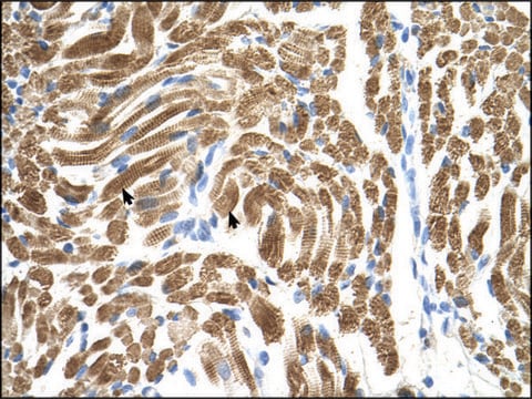 Anti-PEX10 (AB1) antibody produced in rabbit affinity isolated antibody