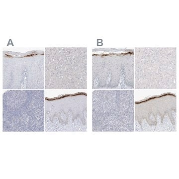 Anti-ASPRV1 antibody produced in rabbit Prestige Antibodies&#174; Powered by Atlas Antibodies, affinity isolated antibody, buffered aqueous glycerol solution