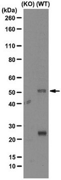 Anti-Cholesterol-24 Hydroxylase Antibody, clone1A7 clone 1A7, from mouse