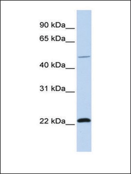 Anti-WWP2 (AB2) antibody produced in rabbit affinity isolated antibody