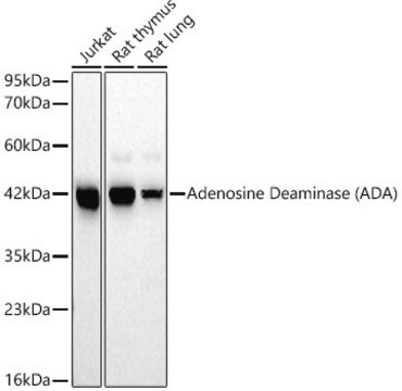 Anti-Adenosine Deaminase (ADA) Antibody, clone 5R10B4, Rabbit Monoclonal