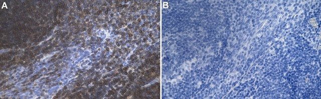 Anti-SHIP1 Antibody, clone 1J20 ZooMAb&#174; Rabbit Monoclonal recombinant, expressed in HEK 293 cells