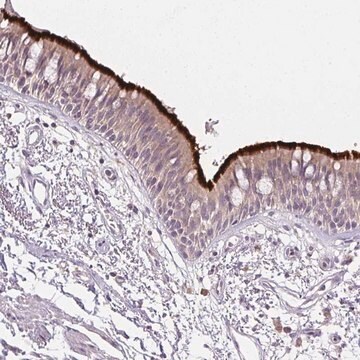 Anti-SPACA9 antibody produced in rabbit Prestige Antibodies&#174; Powered by Atlas Antibodies, affinity isolated antibody