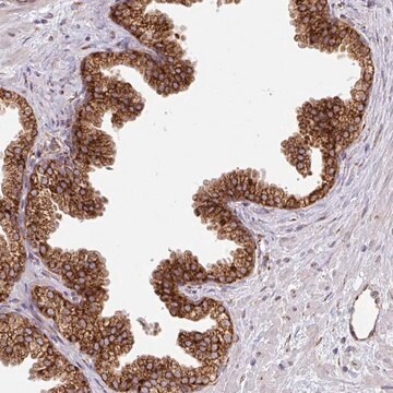 Anti-SLC39A7 antibody produced in rabbit Prestige Antibodies&#174; Powered by Atlas Antibodies, affinity isolated antibody, buffered aqueous glycerol solution