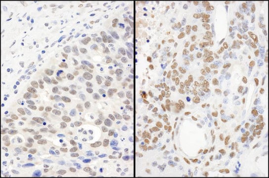 Rabbit anti-FUS Antibody, Affinity Purified Powered by Bethyl Laboratories, Inc.