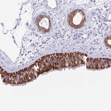 Anti-ZNF781 antibody produced in rabbit Prestige Antibodies&#174; Powered by Atlas Antibodies, affinity isolated antibody, buffered aqueous glycerol solution