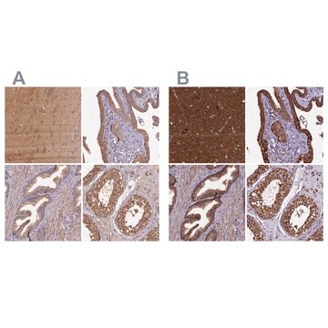 Anti-KLC2 antibody produced in rabbit Prestige Antibodies&#174; Powered by Atlas Antibodies, affinity isolated antibody, buffered aqueous glycerol solution