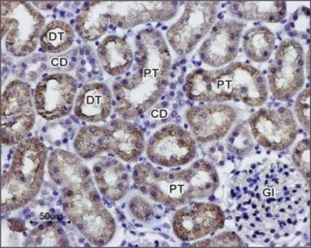 Anti-Water Channel Aquaporin 1 antibody produced in rabbit IgG fraction of antiserum, lyophilized powder