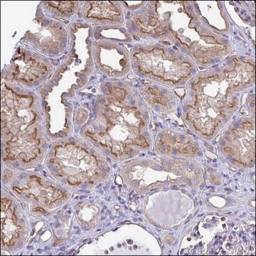 Anti-RPL22L1 antibody produced in rabbit Prestige Antibodies&#174; Powered by Atlas Antibodies, affinity isolated antibody, buffered aqueous glycerol solution