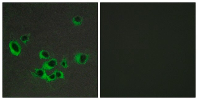 Anti-HTR2B antibody produced in rabbit affinity isolated antibody