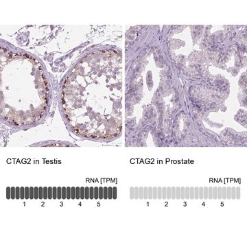 Anti-CTAG2 antibody produced in rabbit Prestige Antibodies&#174; Powered by Atlas Antibodies, affinity isolated antibody, buffered aqueous glycerol solution