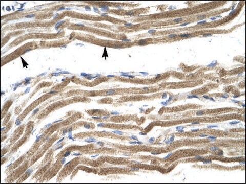 Anti-HOXA10 antibody produced in rabbit IgG fraction of antiserum