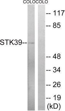 Anti-STK39 antibody produced in rabbit affinity isolated antibody