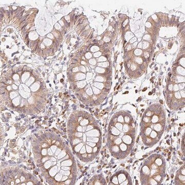 Anti-SLC35B3 antibody produced in rabbit Prestige Antibodies&#174; Powered by Atlas Antibodies, affinity isolated antibody, buffered aqueous glycerol solution