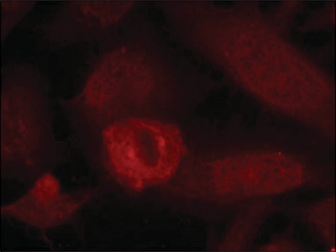 Anti-IRS1 (Ab-639) antibody produced in rabbit affinity isolated antibody