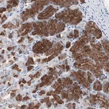 Anti-ADNP2 antibody produced in rabbit Prestige Antibodies&#174; Powered by Atlas Antibodies, affinity isolated antibody, buffered aqueous glycerol solution