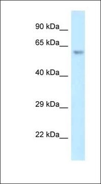 Anti-ERG antibody produced in rabbit affinity isolated antibody | Sigma ...