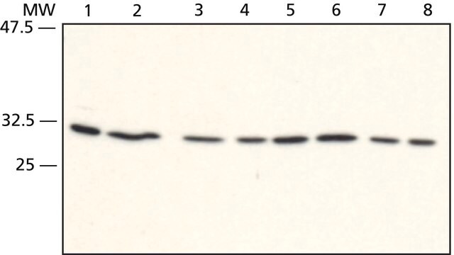 Anti-RACK1 (C-terminal) in Kaninchen hergestellte Antikörper ~1&#160;mg/mL, affinity isolated antibody, buffered aqueous solution, immunoprecipitation: 5 &#956;g