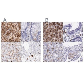 Anti-GLA antibody produced in rabbit Ab1, Prestige Antibodies&#174; Powered by Atlas Antibodies, affinity isolated antibody, buffered aqueous glycerol solution