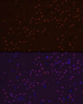 Anti-SATB2 Antibody, clone 3F9E1, Rabbit Monoclonal