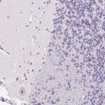 Anti-ST8SIA3 antibody produced in rabbit Prestige Antibodies&#174; Powered by Atlas Antibodies, affinity isolated antibody, buffered aqueous glycerol solution