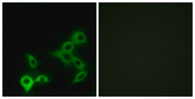 Anti-GPBAR antibody produced in rabbit affinity isolated antibody