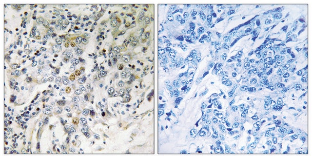 Anti-ELL2 antibody produced in rabbit affinity isolated antibody