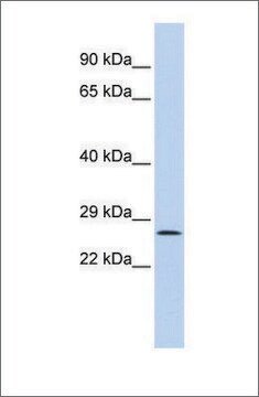 Anti-GATAD1 antibody produced in rabbit affinity isolated antibody