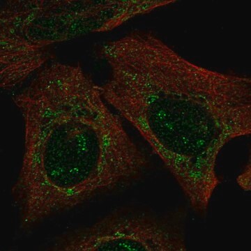 Anti-PARS2 antibody produced in rabbit Prestige Antibodies&#174; Powered by Atlas Antibodies, affinity isolated antibody