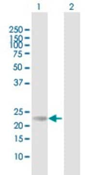 Anti-RS1 antibody produced in mouse purified immunoglobulin, buffered aqueous solution