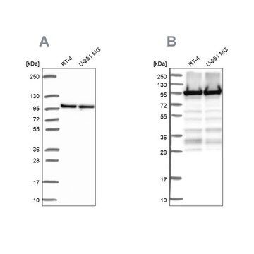 Anti-EEF2 antibody produced in rabbit Prestige Antibodies&#174; Powered by Atlas Antibodies, affinity isolated antibody