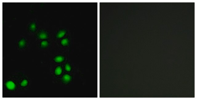 Anti-EXO1 antibody produced in rabbit affinity isolated antibody