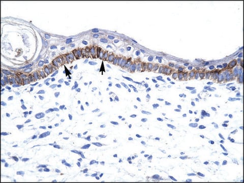 Anti-ARNTL (AB1) antibody produced in rabbit IgG fraction of antiserum