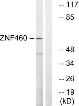 Anti-ZNF460 antibody produced in rabbit affinity isolated antibody