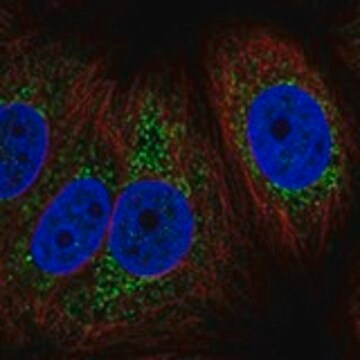 Anti-MT-CYB antibody produced in rabbit Prestige Antibodies&#174; Powered by Atlas Antibodies, affinity isolated antibody, buffered aqueous glycerol solution