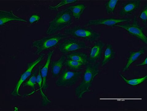 Anti-LAMB1 antibody produced in mouse purified immunoglobulin, buffered aqueous solution