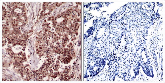 Anti-phospho-NFKB1 (pSer927) antibody produced in rabbit affinity isolated antibody