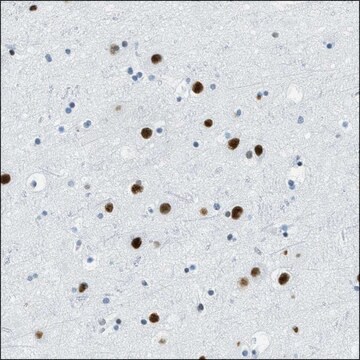 Anti-PLA2G2A antibody produced in rabbit Prestige Antibodies&#174; Powered by Atlas Antibodies, affinity isolated antibody, buffered aqueous glycerol solution