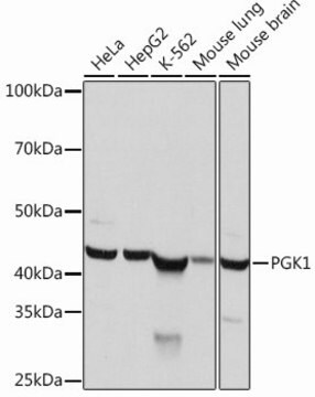 Anti-PGK1 antibody produced in rabbit