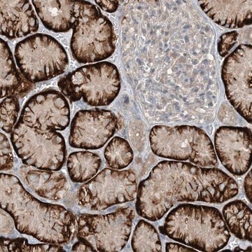 Anti-MITD1 antibody produced in rabbit Prestige Antibodies&#174; Powered by Atlas Antibodies, affinity isolated antibody, buffered aqueous glycerol solution