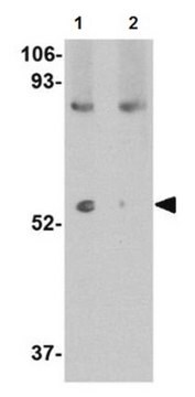 Anti-LGI1 Antibody from rabbit, purified by affinity chromatography