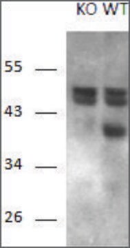 Anti-RCAN1 antibody produced in goat affinity isolated antibody, buffered aqueous solution