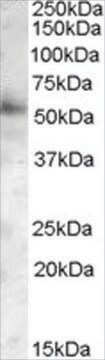 Anti-PIST/FIG/GOPC antibody produced in goat affinity isolated antibody, buffered aqueous solution