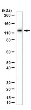 Anti-Beta-Galaktosidase-Antikörper, E.&nbsp;coli from chicken, purified by affinity chromatography